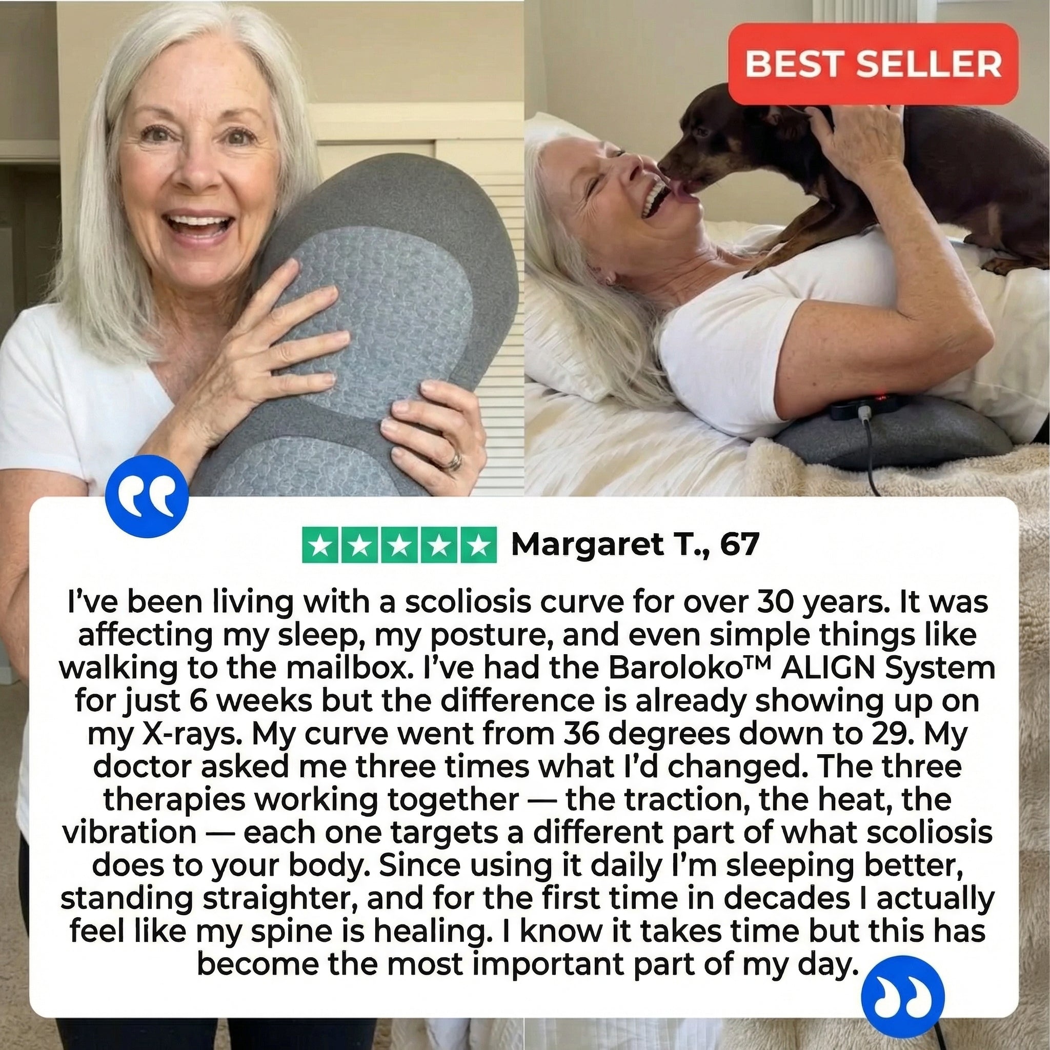 Baroloko™ ALIGN System