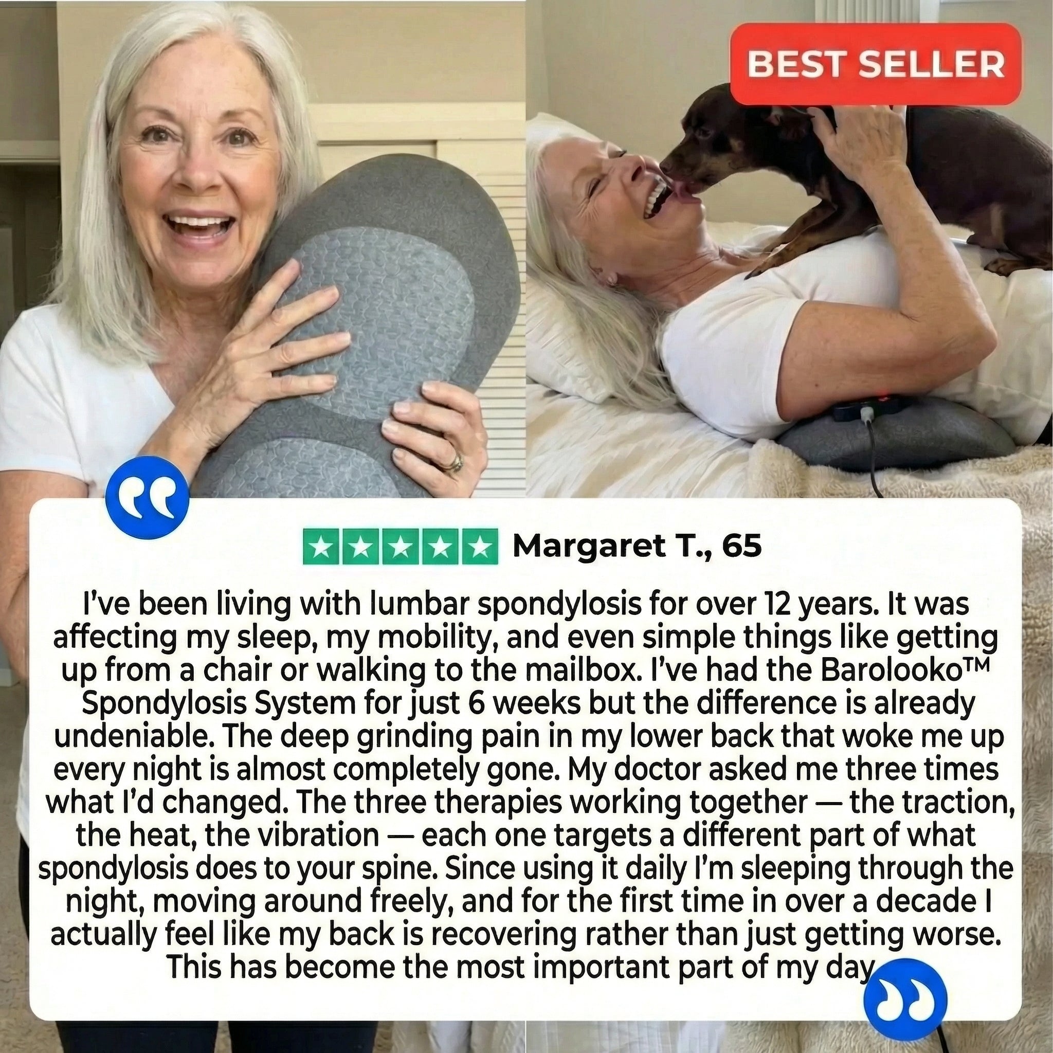 Baroloko™ Spondylosis System